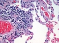 cytologystainseries